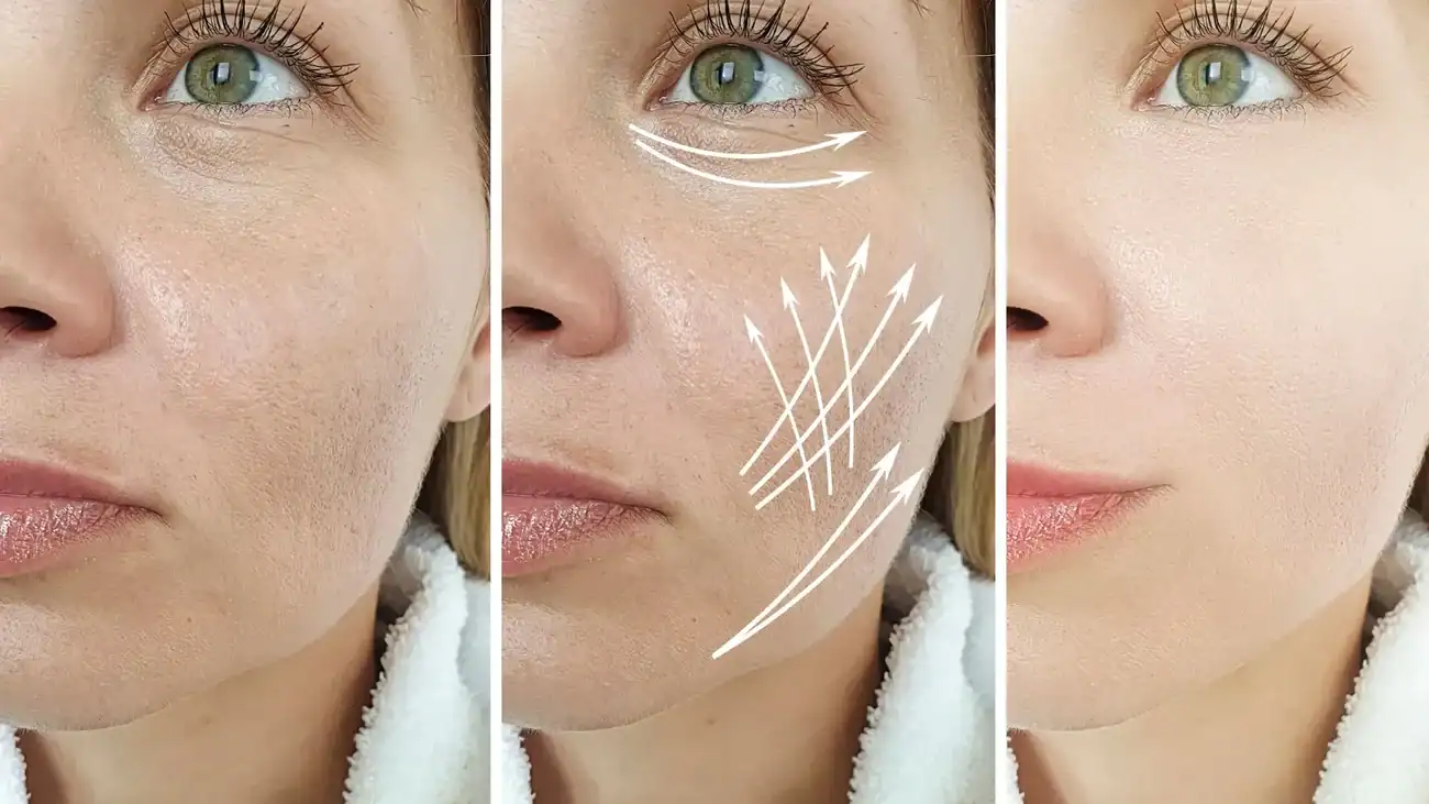 Can One Treatment Really Tackle More Than One Skin Concern Wrexham?