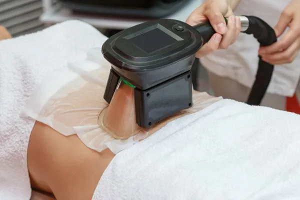 Image of person having fat freezing treatment to help weight gain Wrexham