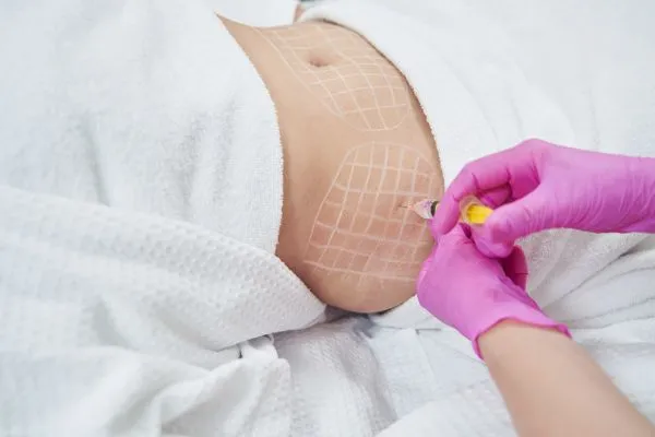 image of fat dissolving injections on love handles to help combat weight gain Wrexham