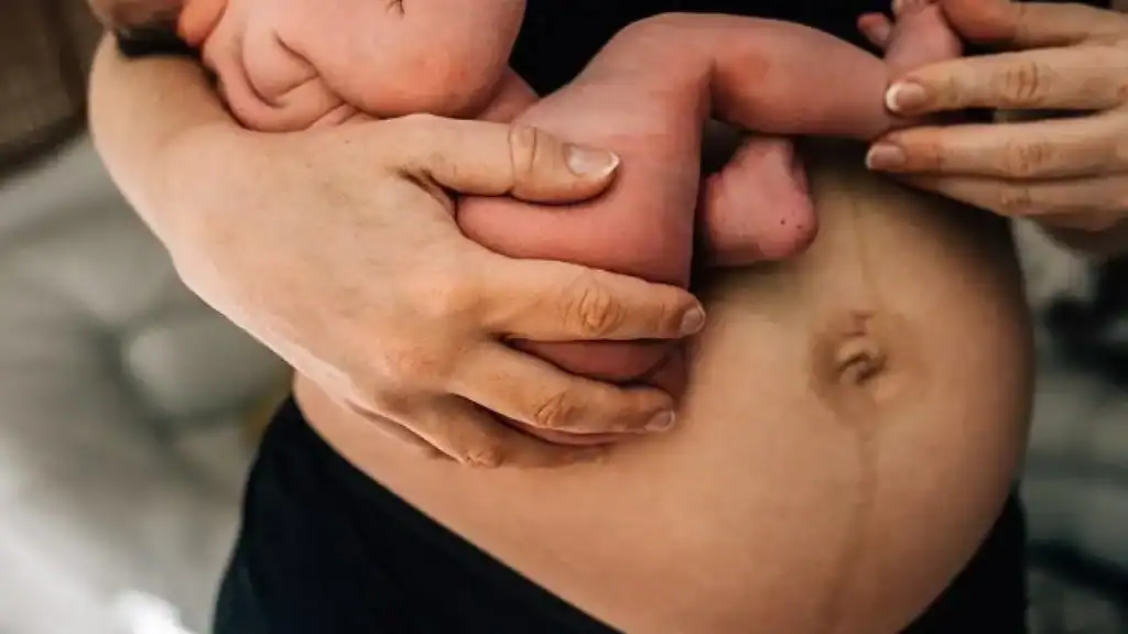 Why Is My Stomach Still Big After Pregnancy Wrexham?